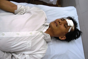 Sửa biển quảng cáo bị hàng xóm đánh nhập viện