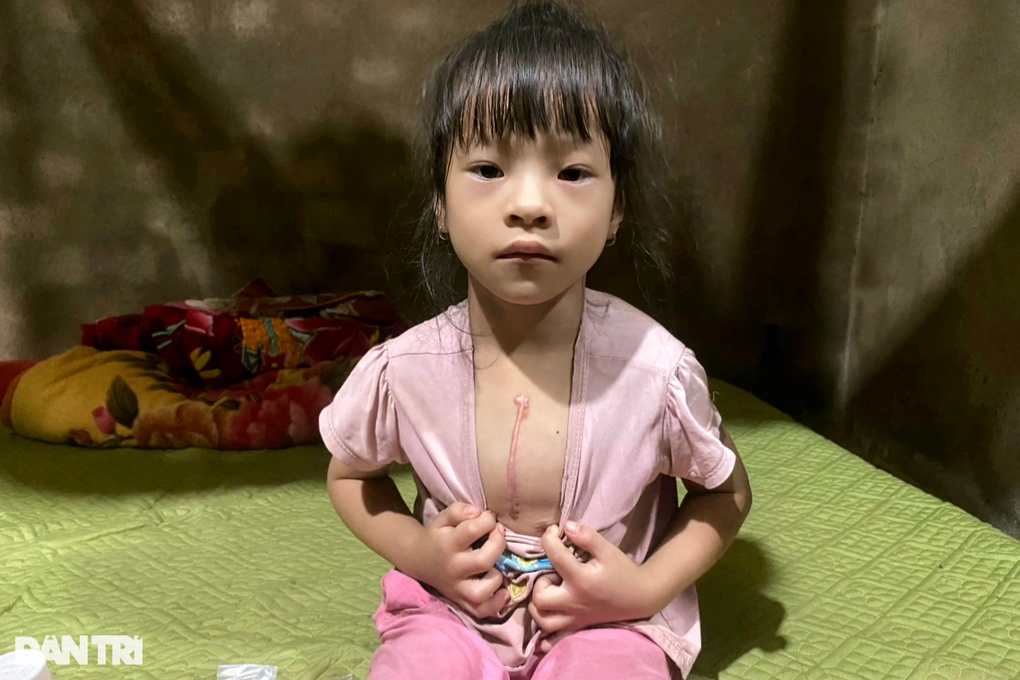 Hi vọng đến với người đàn ông bệnh tật gồng mình nuôi con mắc bệnh tim - 2 Hi vọng đến với người đàn ông bệnh tật gồng mình nuôi con mắc bệnh tim - 2