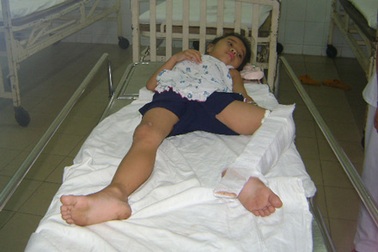 Tường sập đè bị thương 3 học sinh lớp 1