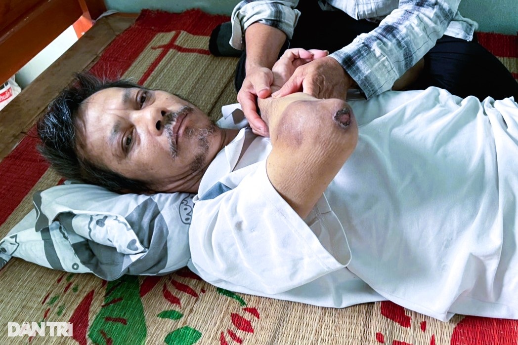 Số phận khốn khổ của người phụ nữ và bé trai bị bỏ rơi ở bìa rừng - 2 Số phận khốn khổ của người phụ nữ và bé trai bị bỏ rơi ở bìa rừng - 2