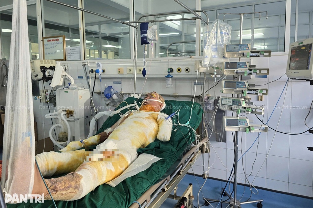 Mẹ ung thư đổ gục khi con trai bỏng điện bất động giữa ranh giới sinh tử - 1 Mẹ ung thư đổ gục khi con trai bỏng điện bất động giữa ranh giới sinh tử - 1