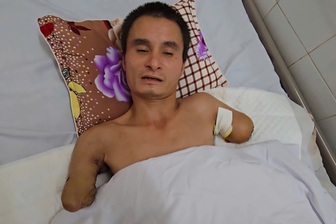 Từ trụ cột thành tàn phế: Lời cầu cứu xé lòng của người bố hai con