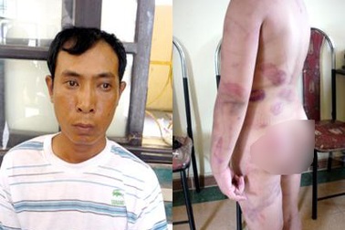 Đánh con dã man bằng thắt lưng