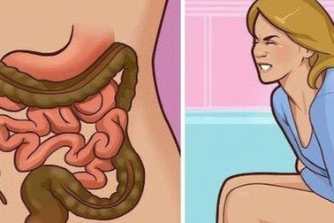 Lối sống thay đổi làm gia tăng ung thư đại trực tràng