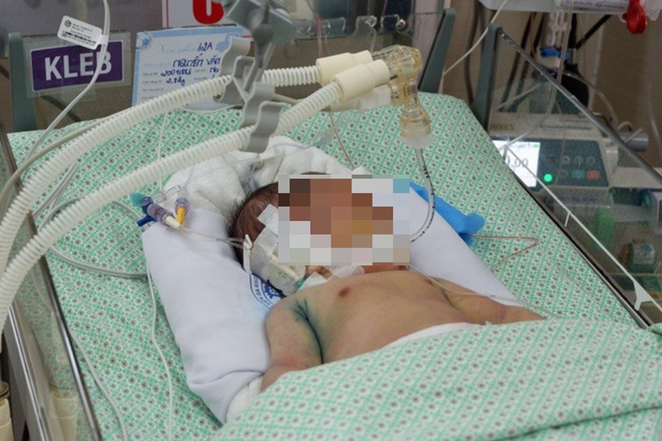 Bé sơ sinh bị bỏ rơi không qua khỏi vì sốc nhiễm khuẩn sau 21 ngày điều trị - 1 Bé sơ sinh bị bỏ rơi không qua khỏi vì sốc nhiễm khuẩn sau 21 ngày điều trị - 1