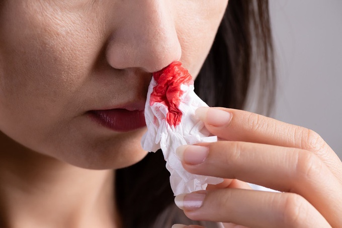 Có những bệnh u lành tính nào có thể gây chảy máu cam thường xuyên trong vòm mũi và vòm họng?
