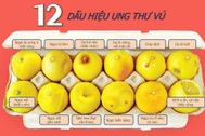 Phát hiện ung thư vú nhờ vào bức hình về 12 quả chanh