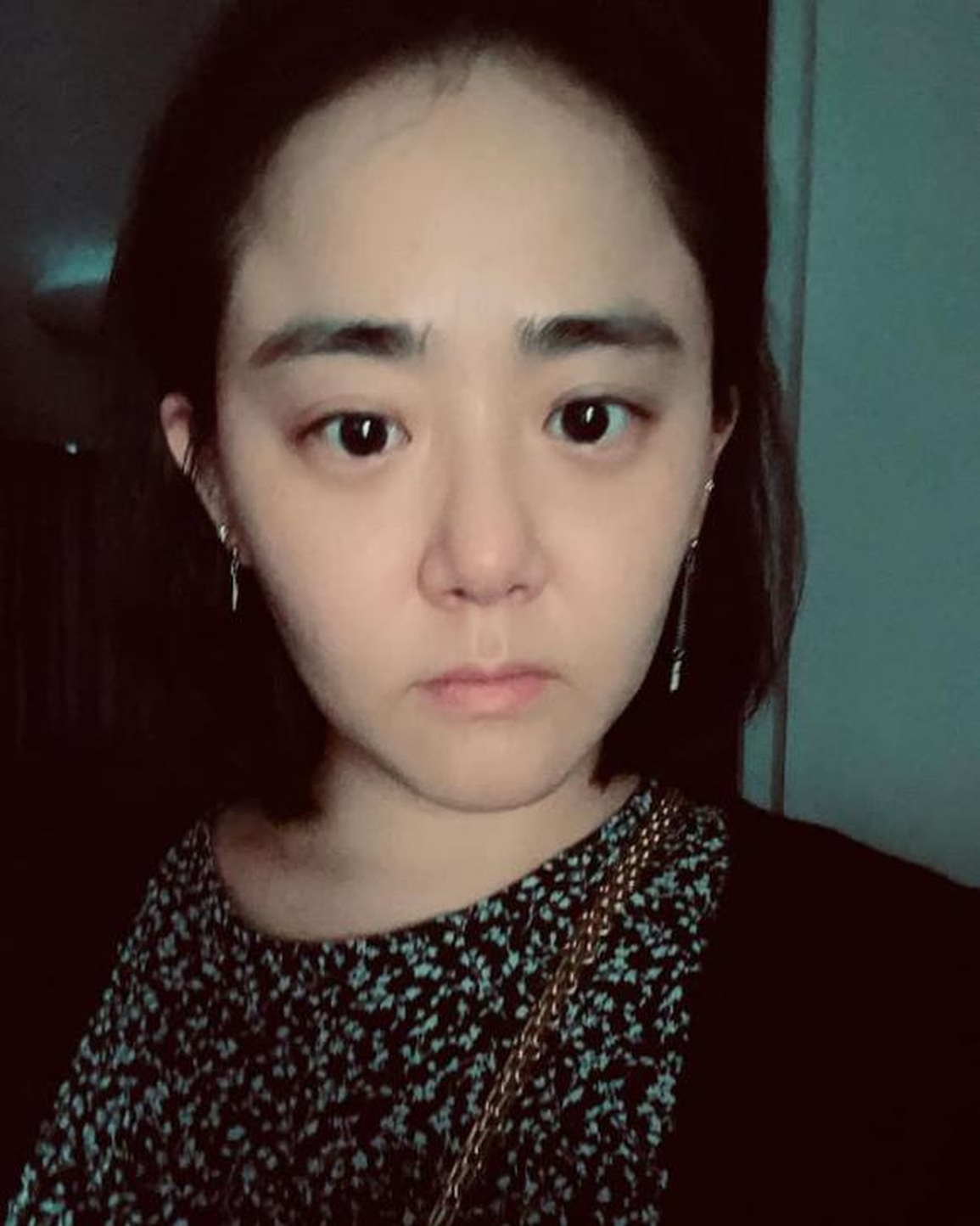 Bệnh tật khiến em gái quốc dân Moon Geun Young trở nên khác lạ - 11 Bệnh tật khiến em gái quốc dân Moon Geun Young trở nên khác lạ - 11
