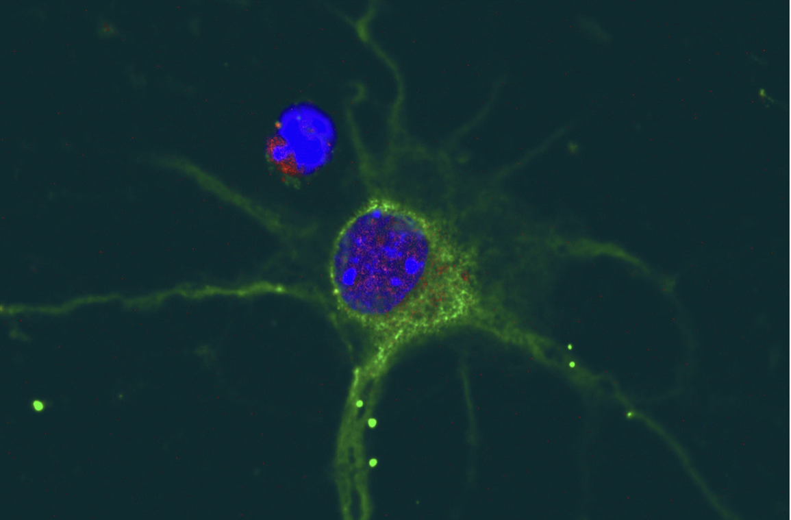 DNA rác có thể giúp con người dập tắt ký ức về nỗi sợ hãi - 1 DNA rác có thể giúp con người dập tắt ký ức về nỗi sợ hãi - 1