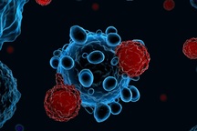 Ứng dụng AI trong chẩn đoán ung thư buồng trứng