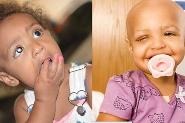 Mẹ phát hiện con gái mắc bệnh ung thư hiếm gặp nhờ mạng xã hội