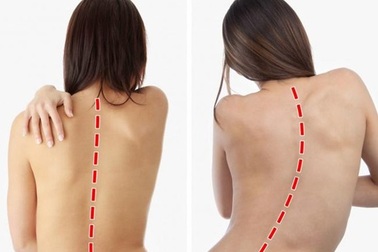 Chuyên gia cảnh báo những tác hại khôn lường của thói quen ngồi nhiều, lười vận động