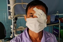 Người đàn ông bị cò mổ thủng mắt trái