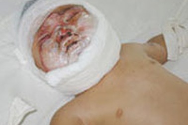 Hiểm họa từ xe tập đi