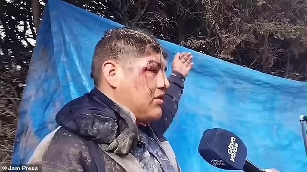 Bị chôn sống khi ngất xỉu, người đàn ông đập vỡ nắp quan tài để thoát ra? - 2