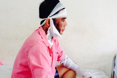 Quản lý công ty nước ngoài bị tạt a-xít dã man