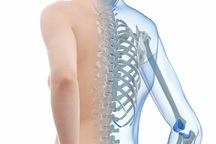 Ô nhiễm không khí có thể gây loãng xương