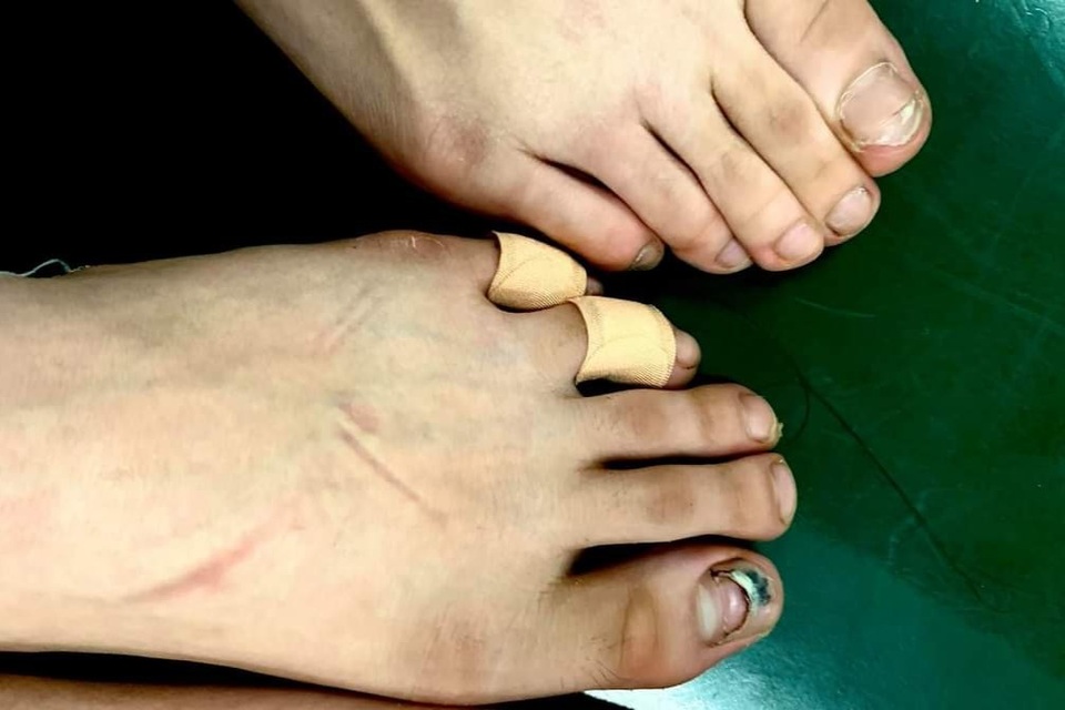 Đôi chân rướm máu và nước mắt gian khổ của học sinh trường Múa - 10 Đôi chân rướm máu và nước mắt gian khổ của học sinh trường Múa - 10