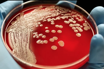 Phát hiện hơn 12.000 loài vi khuẩn hoàn toàn mới