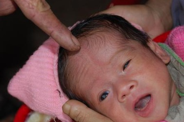 Lạ lùng vùng đất có căn bệnh mở hộp sọ