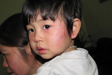 Đình chỉ công tác cô giáo dùng thước đánh vào mặt cháu bé 2 tuổi