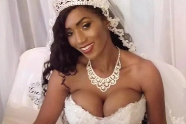 Sống chung với thảm họa phẫu thuật nâng ngực suốt 16 năm