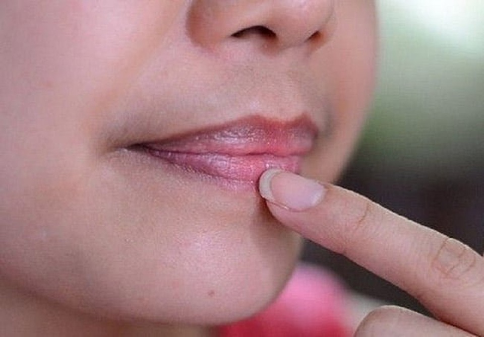 Kiểm tra lá gan khi 4 bộ phận cơ thể này chuyển màu bất thường - 3 Kiểm tra lá gan khi 4 bộ phận cơ thể này chuyển màu bất thường - 3