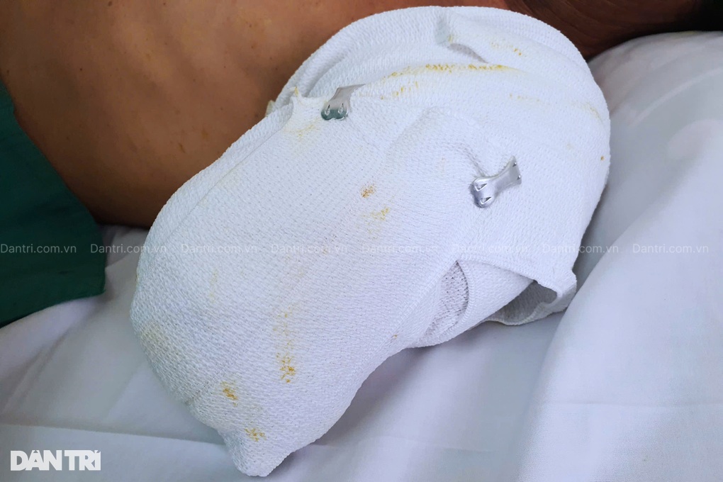 Người đàn ông bị điện phóng cụt 2 tay nghẹn ngào: Mọi người đừng như tôi - 3 Người đàn ông bị điện phóng cụt 2 tay nghẹn ngào: Mọi người đừng như tôi - 3
