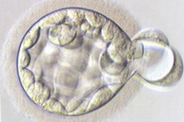 Niềm hy vọng mới cho người hiếm muộn