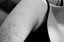 Giật mình người trẻ rạch tay, uống thuốc ngủ... trong mùa Giáng sinh