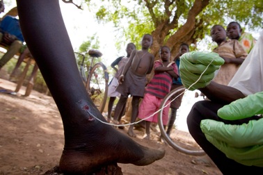 7 bệnh dịch nguy hiểm nhất thế giới