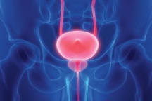 Mách bạn cách tránh ung thư bàng quang