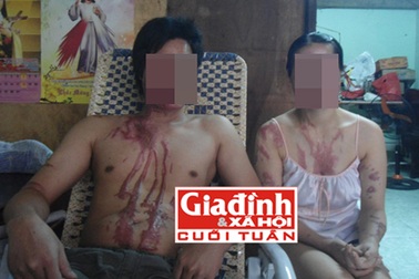 Ca hóa chất xé nát giấc mơ lập nghiệp của đôi vợ chồng nghèo 