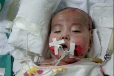 Danh sách ủng hộ bé Nhân Ái (cập nhật lúc 18h00 ngày 27/7)