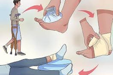 Đừng chủ quan khi bị bong gân, chảy máu...