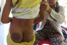 Không thuộc bài, nữ sinh lớp 4 bị thầy giáo đánh bầm mông