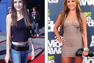 Amanda Bynes bị ám ảnh bởi cân nặng 