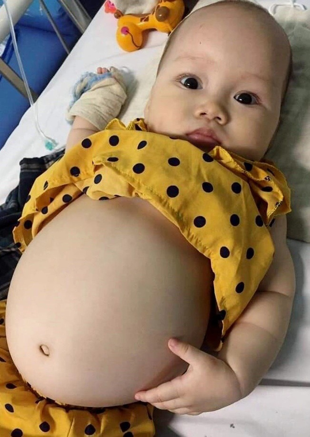 Đau xé lòng cảnh bé gái 10 tháng tuổi bị cắt một quả thận cầu cứu! - 2 Đau xé lòng cảnh bé gái 10 tháng tuổi bị cắt một quả thận cầu cứu! - 2