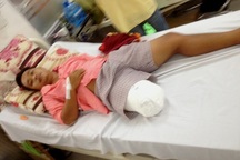 Vụ bệnh nhân bị cưa chân: Đúng quy trình nhưng đánh giá... chưa đầy đủ