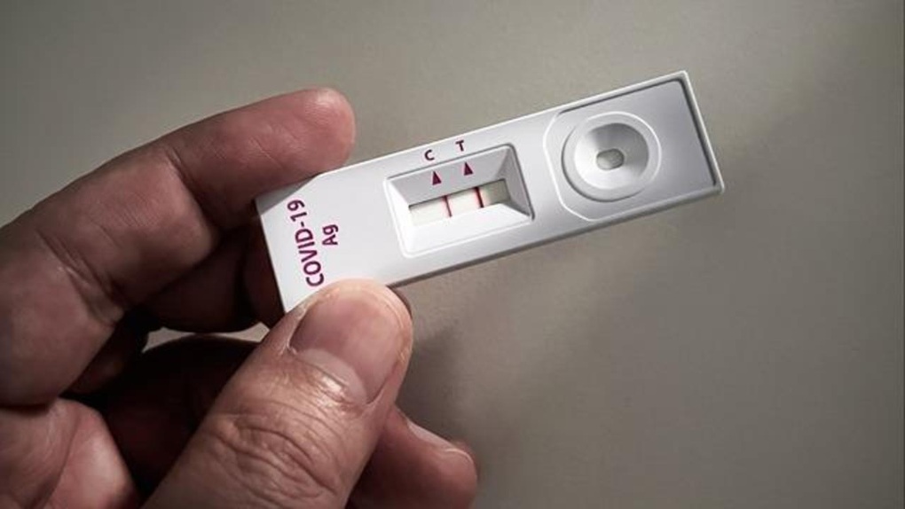 WHO theo dõi biến thể SARS-CoV-2 mới đang lây lan ở Mỹ, Trung Quốc - 1 WHO theo dõi biến thể SARS-CoV-2 mới đang lây lan ở Mỹ, Trung Quốc - 1
