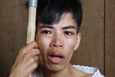 Đớn đau thiếu phụ bị ung thư đánh đổi mạng sống để sinh con