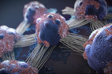 Giả mã bí ẩn 100 năm tuổi về bệnh ung thư