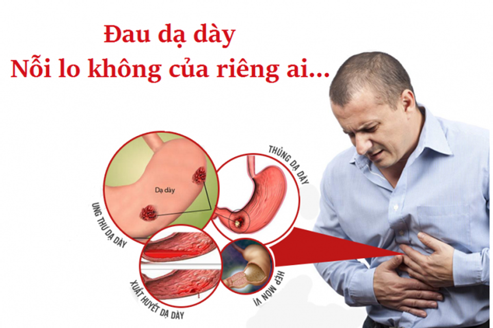 Khang Vị An - Hỗ trợ giảm nguy cơ biến chứng bệnh đau dạ dày - 2 Khang Vị An - Hỗ trợ giảm nguy cơ biến chứng bệnh đau dạ dày - 2