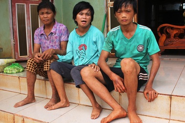 Mẹ bị suy thận giai đoạn cuối “gồng mình” nuôi 2 con tật nguyền