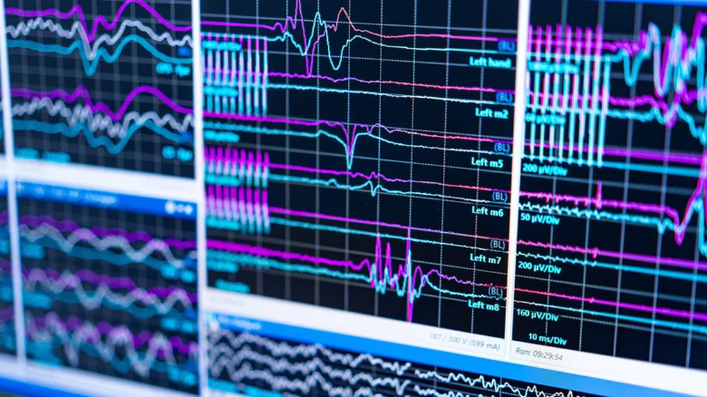 Hé lộ bí ẩn về cuộc đời vụt qua trước mắt khi cận kề cái chết - 1 Hé lộ bí ẩn về cuộc đời vụt qua trước mắt khi cận kề cái chết - 1