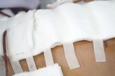 Vụ tai biến sau hút mỡ ở TPHCM: Nạn nhân "tha thiết" mổ dù có bệnh nền?