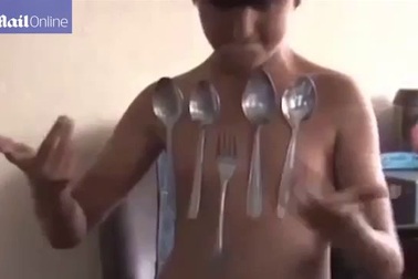 Cậu bé 9 tuổi biến thành... cục nam châm mỗi khi tức giận