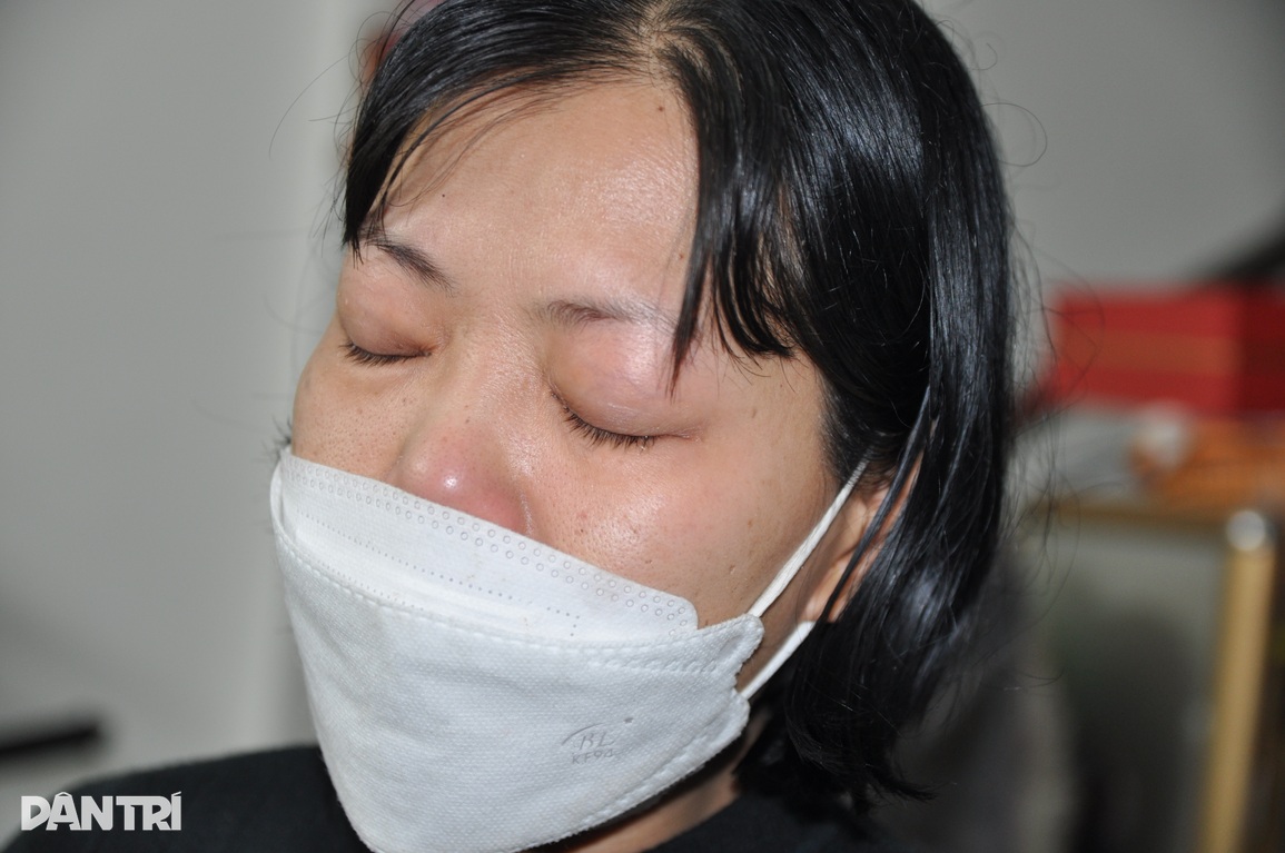 Xót thương bé gái vật vã suốt 5 năm với phần ruột nằm ngoài cơ thể - 3 Xót thương bé gái vật vã suốt 5 năm với phần ruột nằm ngoài cơ thể - 3