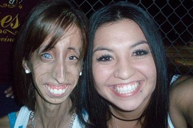 Ảnh cô gái siêu gầy của nước Mỹ