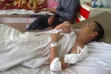 Bỗng dưng bị đâm nhiều nhát vào người